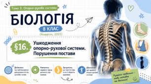 Ушкодження опорно-рухової системи. Порушення постави. Презентація, інфографіка, робочий аркуш