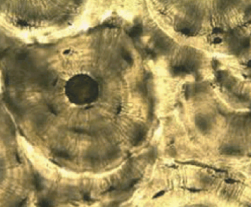 11009x4m-24d4-354x291.png