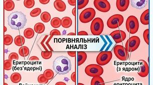 Лабораторне дослідження "Мікроскопічна будова крові"