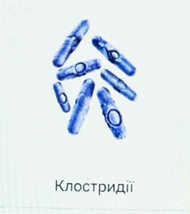1100b19d-d6c2-190x214.png