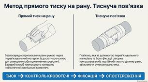 Презентація "Метод прямого тиску на рану. Тиснуча пов'язка"