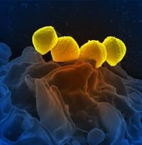 Streptococcus pyogenes — Вікіпедія