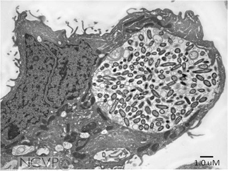 Rickettsia - NCVP - National Center for Veterinary Parasitology