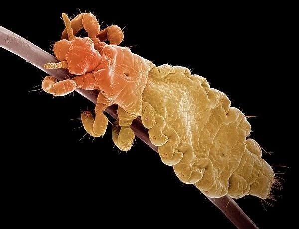 Head louse, SEM Our beautiful Wall Art and Photo Gifts include Framed Prints, Photo Prints, Poster Prints, Canvas Prints, Jigsaw Puzzles, Metal Prints and so much more