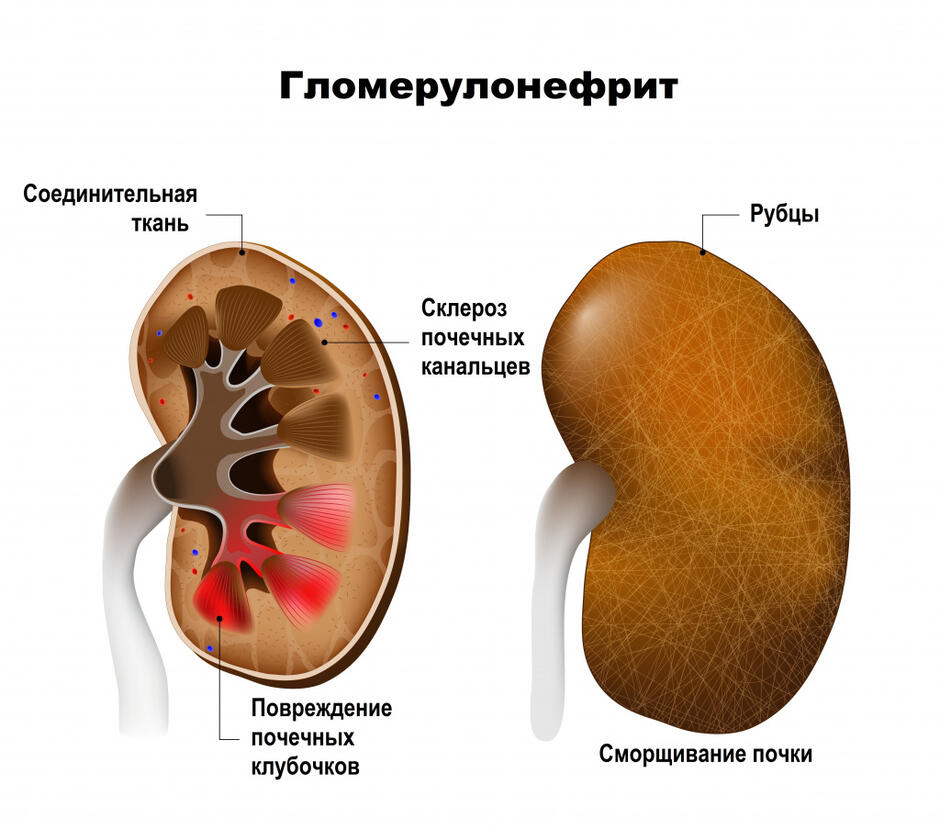 Почки.jpg