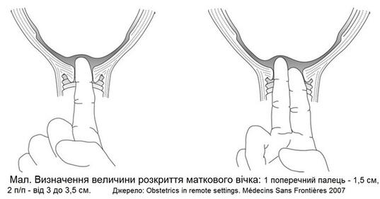 1100ouq3-865e-537x281.jpg